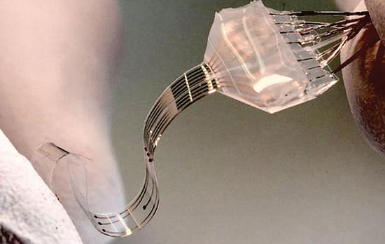 Thiết bị cyborg giúp hồi phục chi liệt