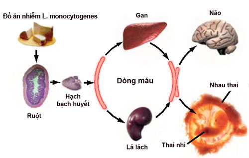 Khuẩn trên táo Mỹ gây bệnh nguy hiểm thế nào?