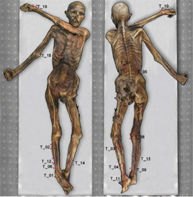 Phát hiện 61 hình xăm trên xác ướp người băng Otzi