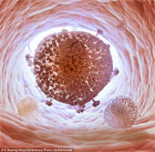 Lần đầu tiên “xóa sổ” virus HIV khỏi tế bào của người