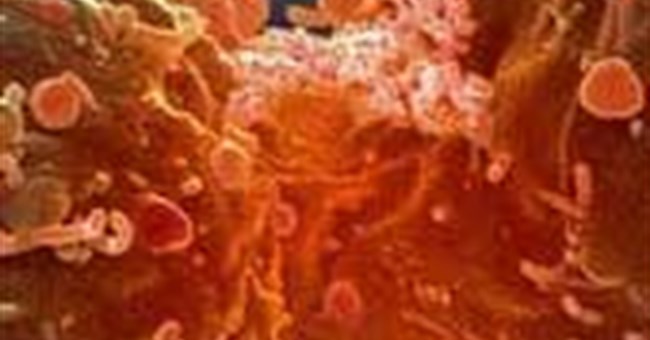 Tại sao ung thư tấn công giết chết con người?