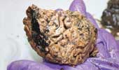 Phát hiện não người được bảo quản trong lớp bùn suốt 2.600 năm