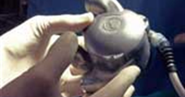 Thử nghiệm cấy ghép tim nhân tạo không nhịp đập