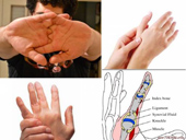 Thói quen bẻ đốt ngón tay gây hại sức khỏe?