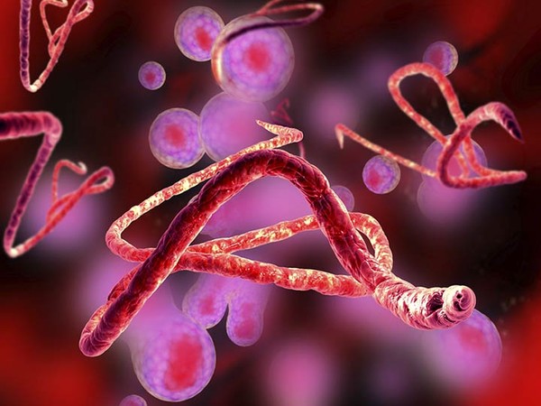 Mắt bị đổi màu sau khi chữa khỏi Ebola