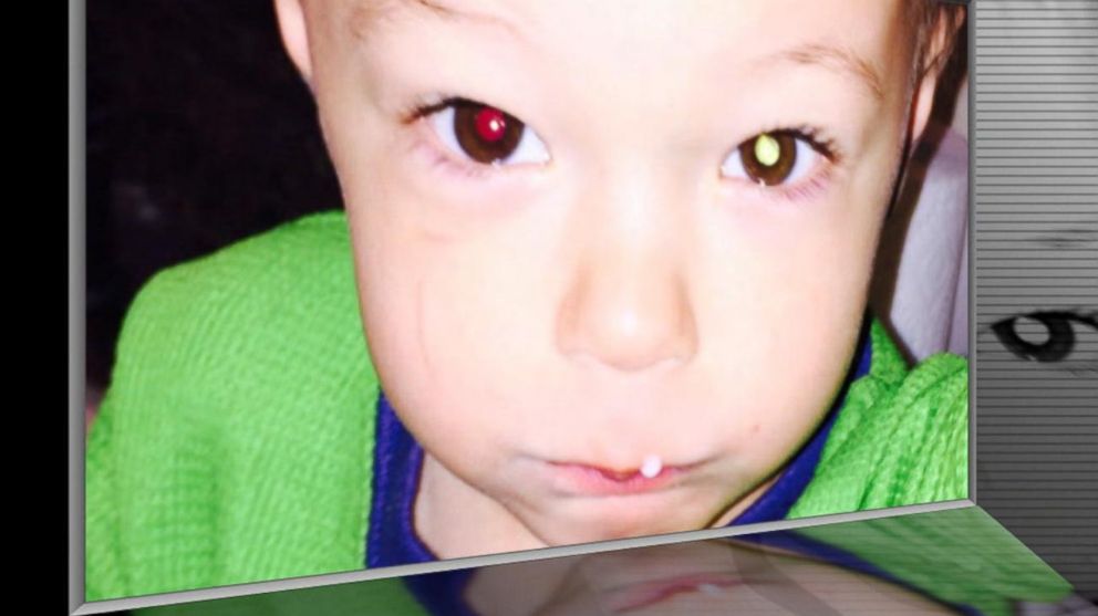 Phát hiện ung thư mắt ở trẻ nhỏ nhờ bật flash khi chụp ảnh