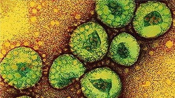 Virus MERS đang gây hoang mang nhất hiện nay nguy hiểm đến đâu