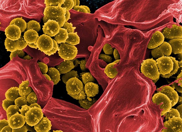 Staphylococcus aureus hay tụ cầu vàng là một loài tụ cầu khuẩn Gram