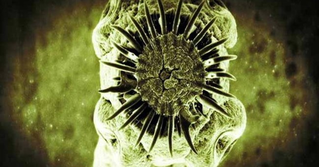 Các loài ký sinh trùng thích làm tổ và ăn não con người