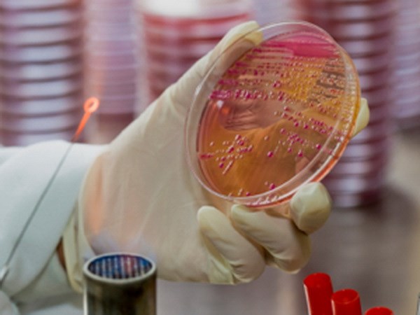 Phát hiện siêu vi khuẩn kháng thuốc gây chết người tại Australia