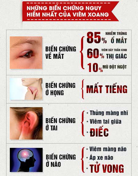 80% bệnh nhân viêm xoang đang điều trị sai cách