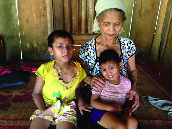 Bệnh lạ đe dọa mạng sống của người dân ở Phú Thọ