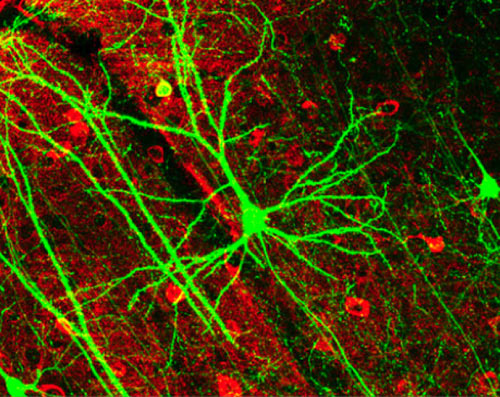 Nơron nhân tạo thay thế dây thần kinh trong não người