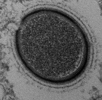 Hồi sinh virus cổ đại 30.000 năm tuổi