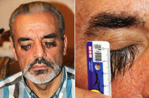 5 kỷ lục gây sốc về bộ phận cơ thể con người