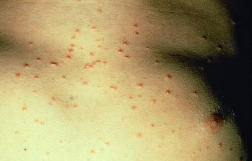 7 căn bệnh bí ẩn khiến y học 