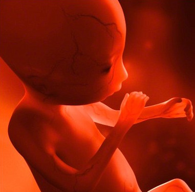 Phát hiện bào thai trong bụng bé trai 4 tuổi