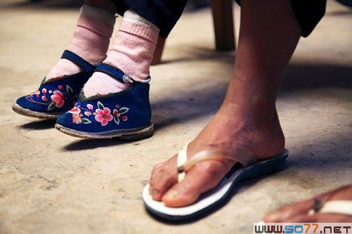 Những bàn chân kỳ lạ trên thế giới