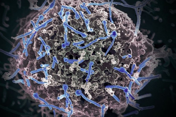 Phát hiện virus Ebola trong tinh trùng người khỏi bệnh 9 tháng trước đó