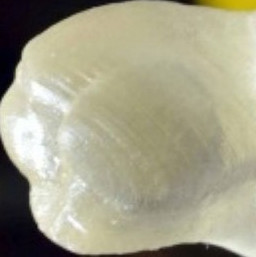 Chiếc răng giả được in 3D có thể tự làm sạch