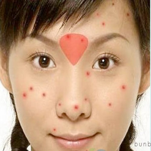 16 vị trí của mụn cảnh báo về sức khỏe