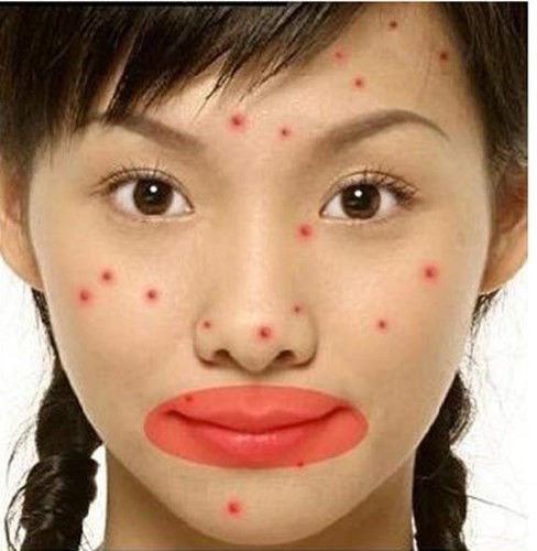 16 vị trí của mụn cảnh báo về sức khỏe