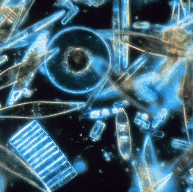 Dùng tảo biến đổi gene làm thuốc chữa ung thư