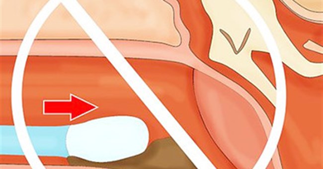 Sau khi xem bức hình này, đảm bảo bạn sẽ không dám ngoáy tai nữa