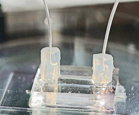 Hé lộ cách tế bào ung thư di căn trong cơ thể người