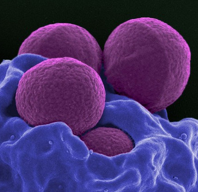 Tìm ra phương pháp tiêu diệt vi khuẩn trong cơ thể hoàn toàn mới