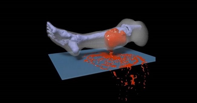 Mô phỏng vết thương ảo để cứu người thật