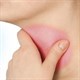 Cách chữa viêm họng hữu hiệu vào mùa đông