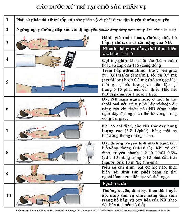 Các bước sơ cứu người bị sốc phản vệ.