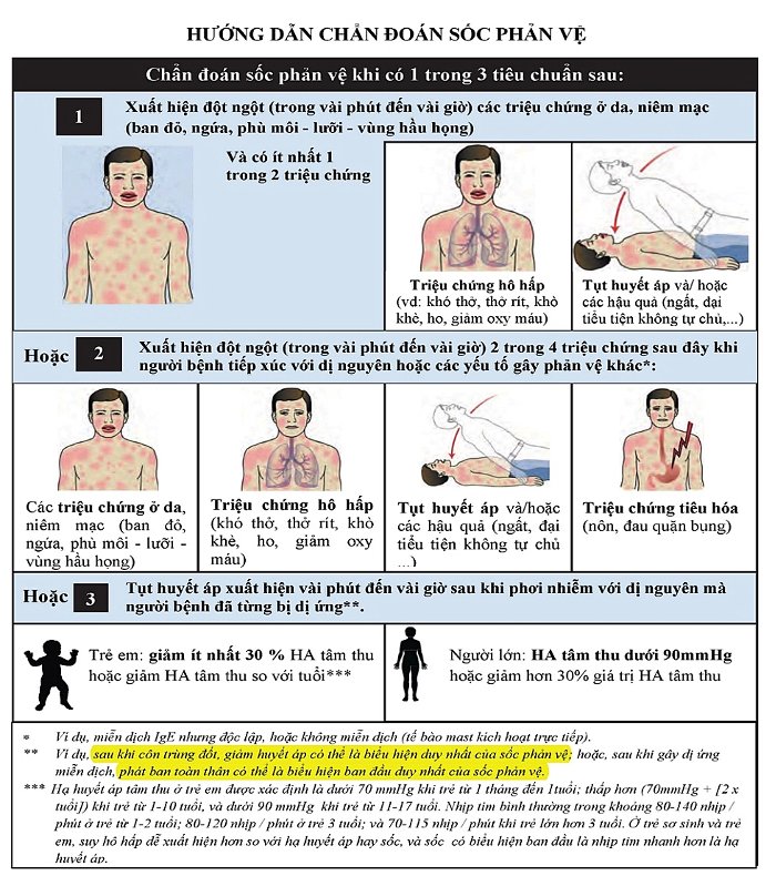 Dấu hiệu chẩn đoán người bị sốc phản vệ.