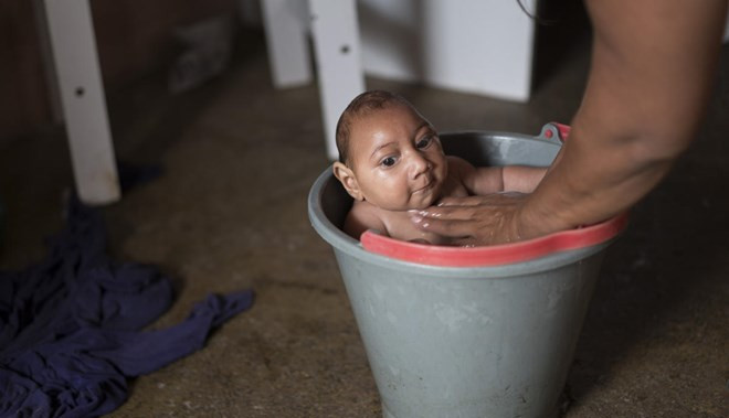 Những trẻ sơ sinh bị bệnh nhỏ não được cho là do virus Zika. 