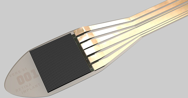 Mắt sáng lại nhờ cấy chip sinh học