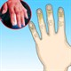Cách chữa trị cho người bị bỏng lạnh