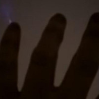 Video: Hiện tượng lạ khiến ngón tay phát quang