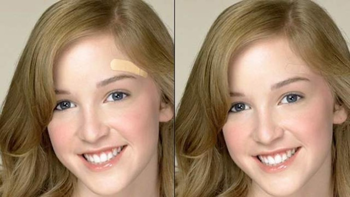 Băng cá nhân tự đổi màu da