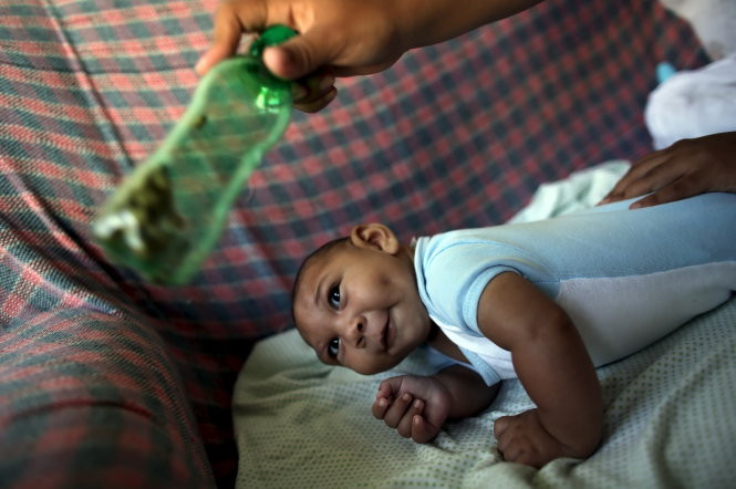 Một bé trai bốn tháng tuổi ở Recife, Brazil bị teo não.