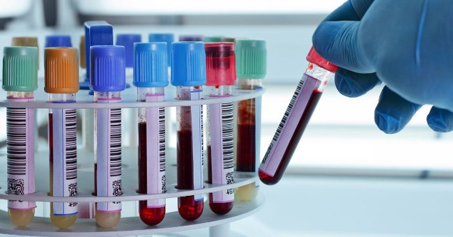 Hướng dẫn cách đọc kết quả xét nghiệm máu