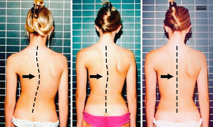 Người làm việc bên máy tính nhiều nhất định phải biết 7 bài tập này cho cột sống