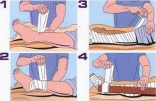 Bị rắn độc cắn, sơ cấp cứu thế nào?