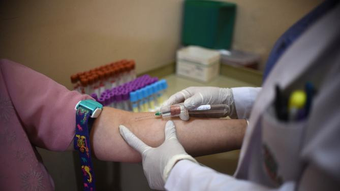 Virus Zika là thủ phạm gây nên hội chứng thần kinh nguy hiểm