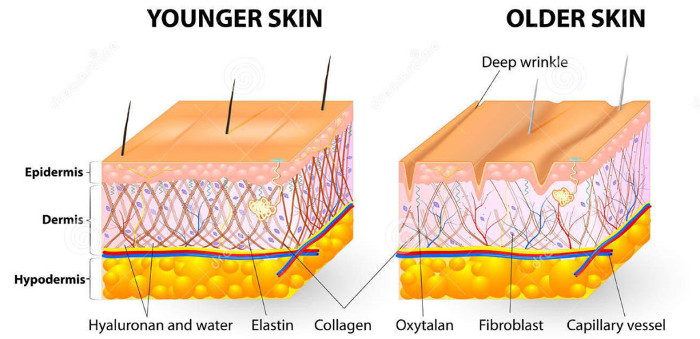 Giảm sản xuất collagen khiến da dễ khô, nứt.