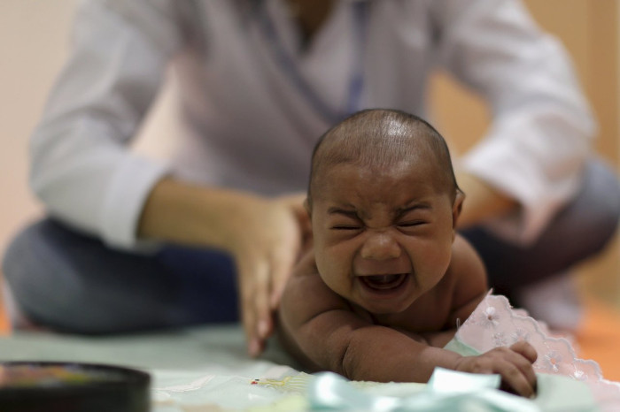 Chứng đầu nhỏ nghi do virus Zika gây ra ở trẻ em.