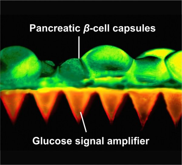 Phát minh giúp người bị tiểu đường không cần phải chú ý tiêm insulin thường xuyên