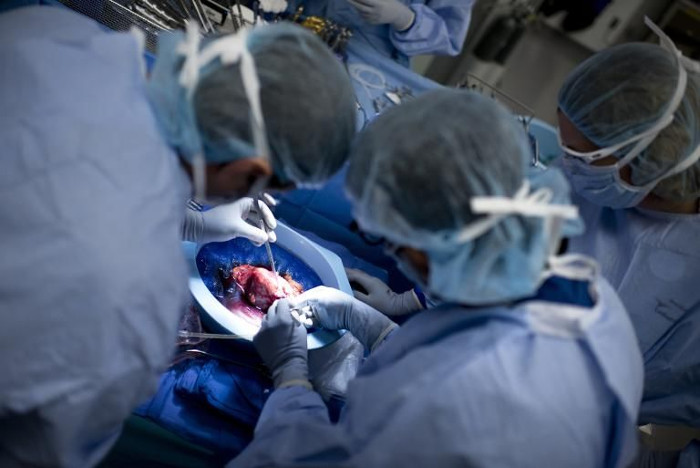 Ca ghép tạng đầu tiên cho người nhiễm HIV