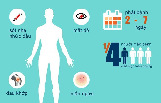 Việt Nam phát hiện 2 ca nhiễm virus Zika đầu tiên