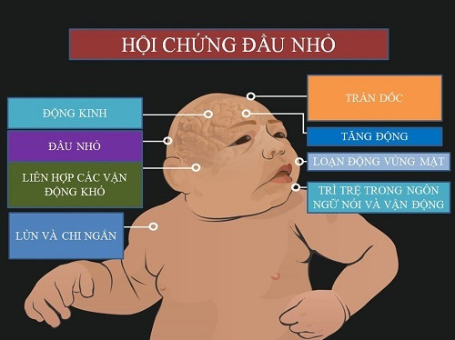 Virus Zika hoành hành trong lịch sử nhân loại như thế nào?